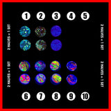 Chubby Inlay Buttons